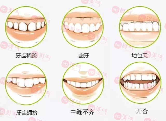 上海九院牙齒正畸哪個(gè)醫(yī)生比較好?楊一鳴、房兵醫(yī)生口碑介紹