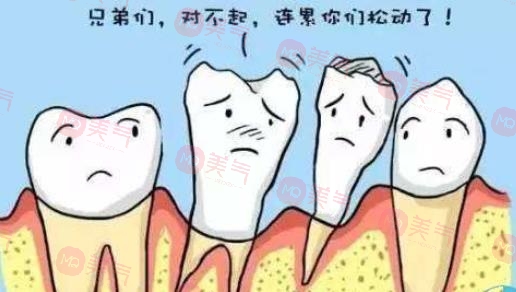 上海種植牙價(jià)格表大全更新！低至5900？?jī)?nèi)附種植牙原理、注意事項(xiàng)