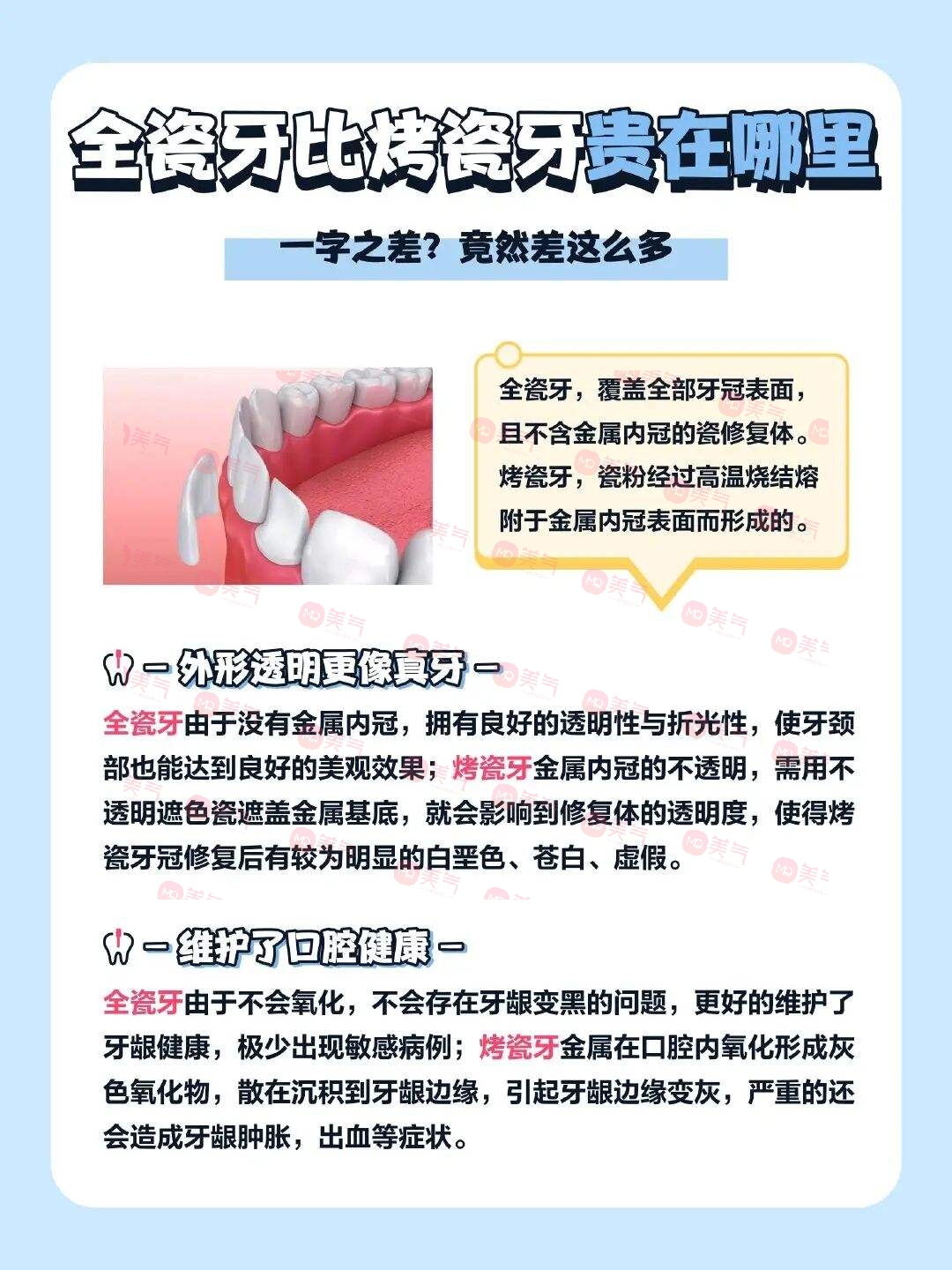 廣州全瓷牙價(jià)格多少？2023費(fèi)用明細(xì)-全瓷牙優(yōu)勢(shì)、注意事項(xiàng)附上