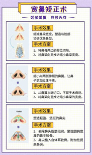 寬鼻梁矯正術真的有嗎?項目簡介_真實案例_優(yōu)缺點介紹