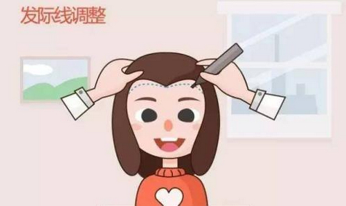 廣州青逸植發(fā)醫(yī)院靠譜嗎？醫(yī)生詳情及頭發(fā)種植案例
