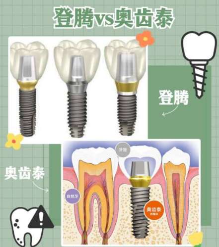 種植牙哪一種品牌最好？介紹10個比較有名的品牌