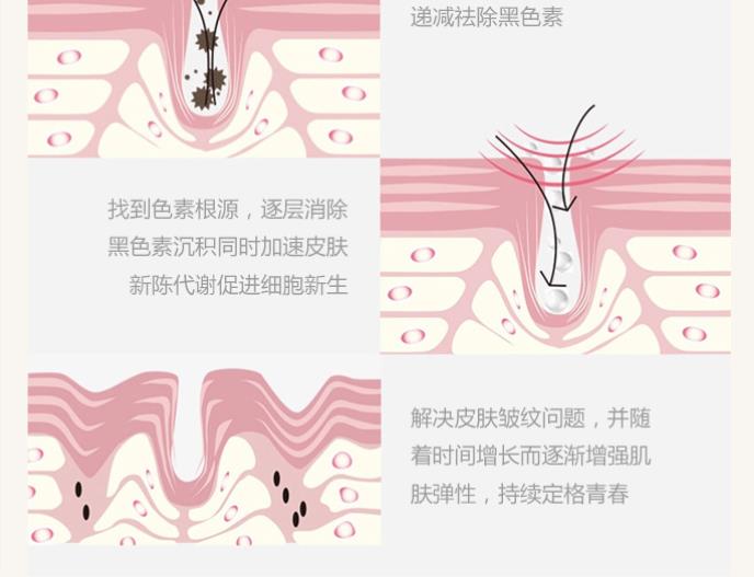 點(diǎn)陣激光.jpg