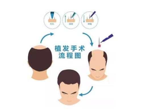 武漢九洲植發(fā)醫(yī)生怎么樣？擁有較高的技術(shù)水平，而且也服務(wù)了眾多的愛(ài)美者