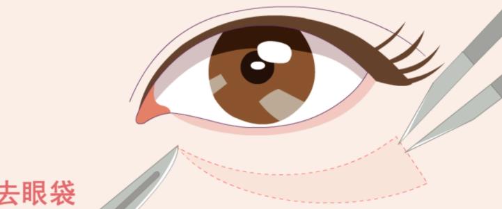 去眼袋動漫04.jpg
