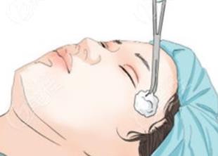雙眼皮修復(fù)動漫h25.jpg