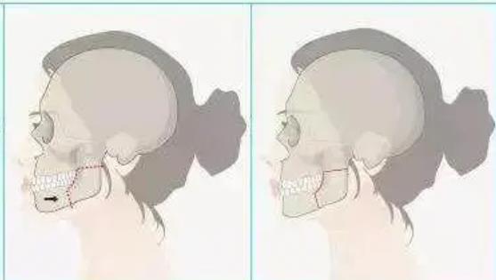 正頜動漫01.jpg