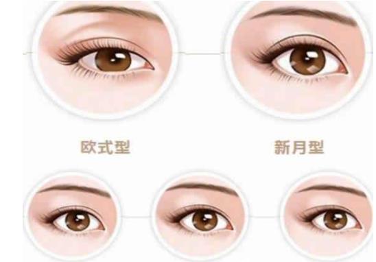 雙眼皮動漫hg5.jpg