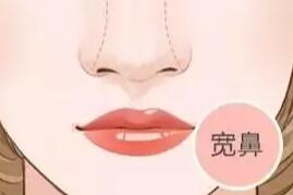 隆鼻動(dòng)漫42.jpg