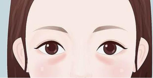 去眼袋動漫01.jpg