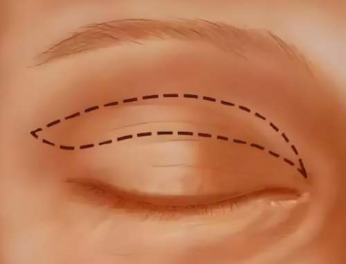 李方奇和王紹國誰的技術好？一鍵了解兩位醫(yī)生信息