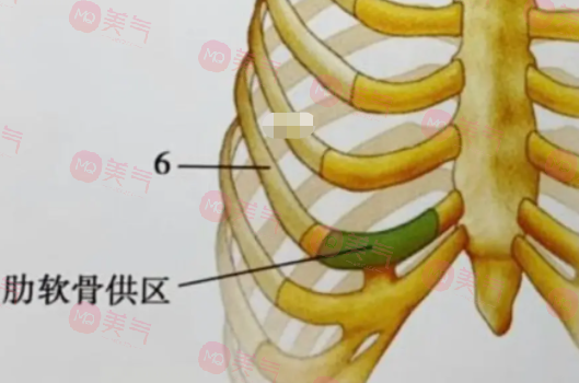 自體肋骨隆鼻的危害有哪些？手術風險、疼痛和腫脹…