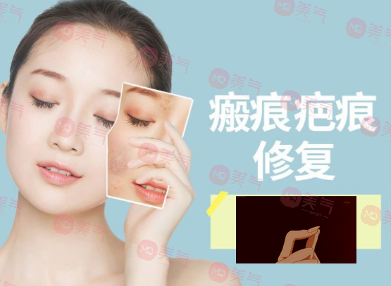 除疤痕最有效的方法，激光治療、碳酸鈣注射、纖維蛋白填充…