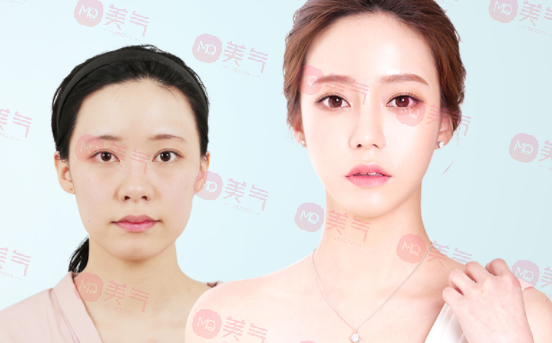 北京八大處整容醫(yī)院做輪廓整形多少錢？