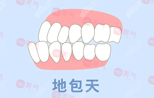 地包天矯正需要多少費用？骨性地包天整形費用2-4萬起