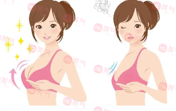 重慶豐胸得多錢？2萬的曼托假體隆胸要不要做